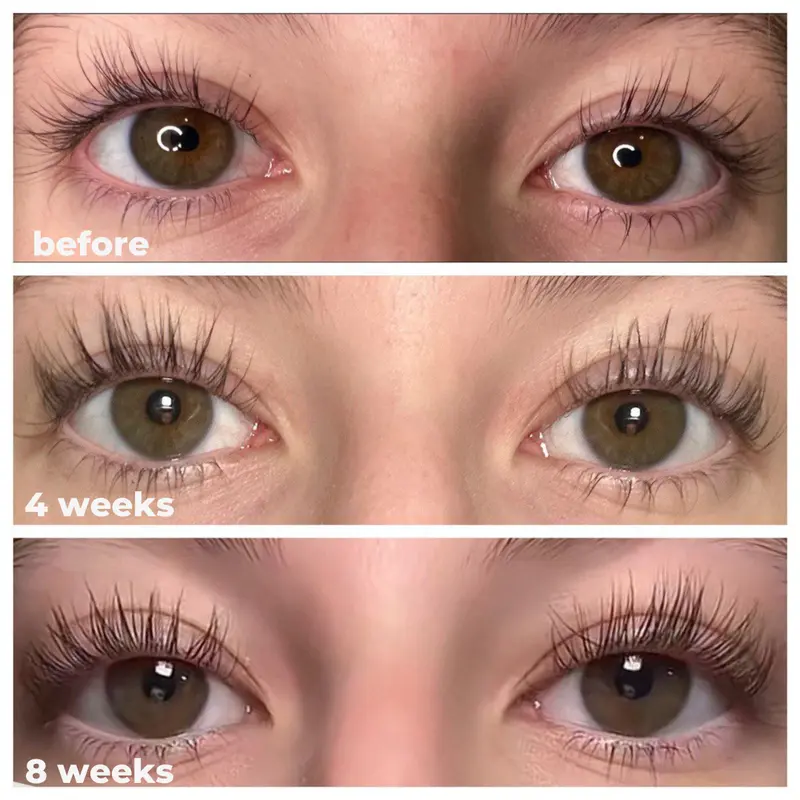 👁️Medazy Eyelash Growth Serum 8ML✅FDA Approved👩⚕️(Grow Thicker, Longer, Healthier Lashes) 👀