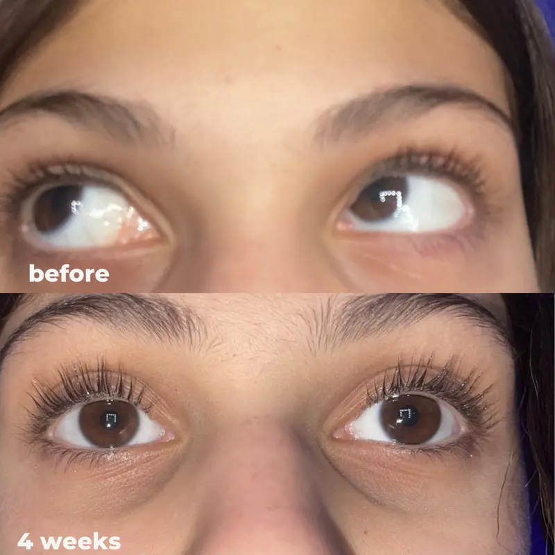 👁️Medazy Eyelash Growth Serum 8ML✅FDA Approved👩⚕️(Grow Thicker, Longer, Healthier Lashes) 👀