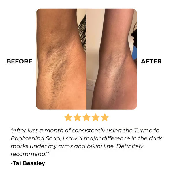 🔥Turmeric & Kojic Acid Brightening Soap