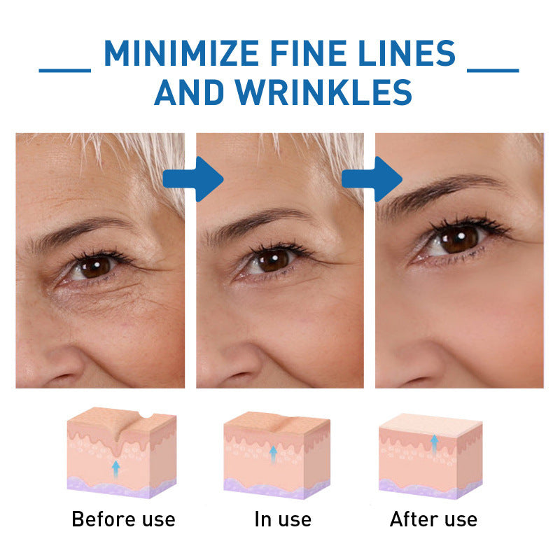 🎁Winter Special-88%-NESLEMY Botox Facial Serum