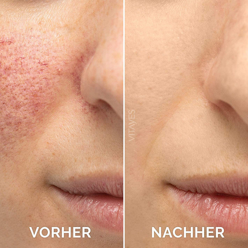 🎁Winter Special-80%-Insideefy Firming Peptide Lifting Serum