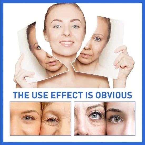 🎁Winter Special-88%-NESLEMY Botox Facial Serum