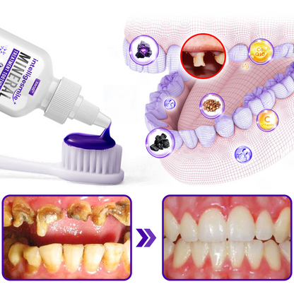 🥇BBOJI™ IntelligeSmile Mineral Treatment Toothpaste