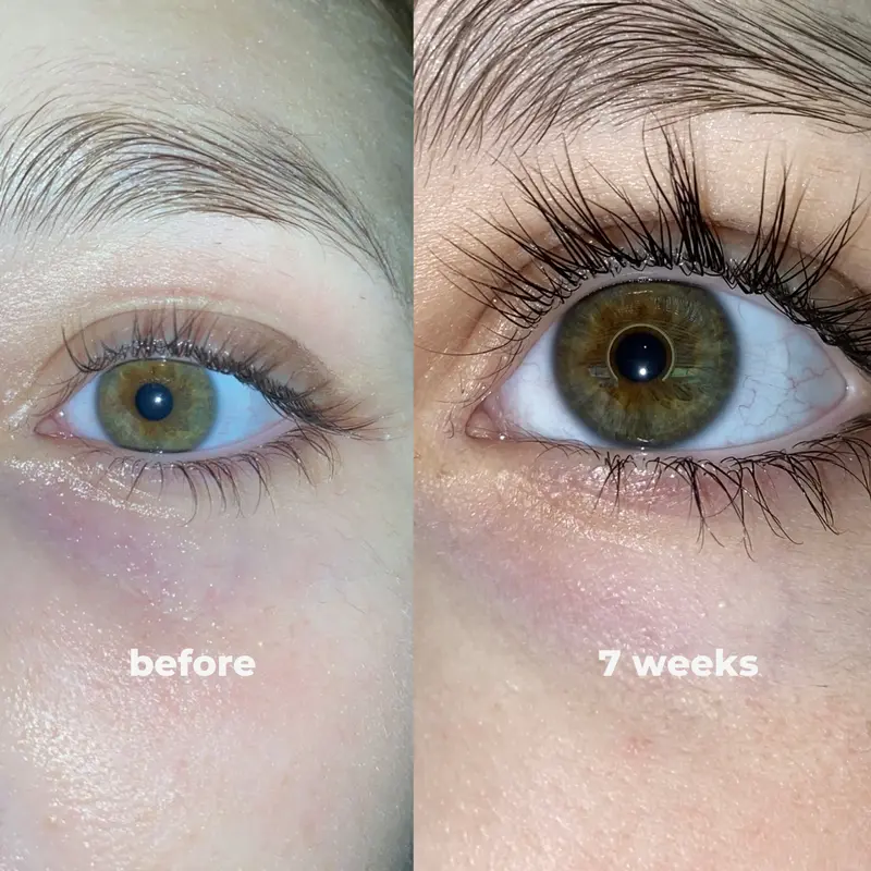 👁️Medazy Eyelash Growth Serum 8ML✅FDA Approved👩‍⚕️(Grow Thicker, Longer, Healthier Lashes) 👀