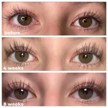 👁️Medazy Eyelash Growth Serum 8ML✅FDA Approved👩‍⚕️(Grow Thicker, Longer, Healthier Lashes) 👀