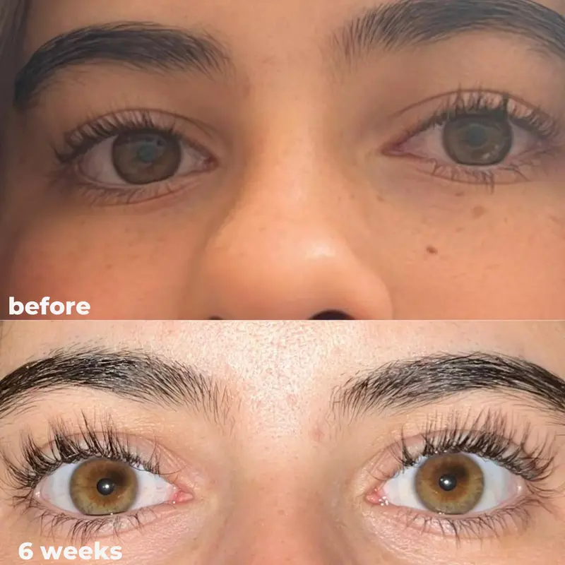 👁️Medazy Eyelash Growth Serum 8ML✅FDA Approved👩‍⚕️(Grow Thicker, Longer, Healthier Lashes) 👀