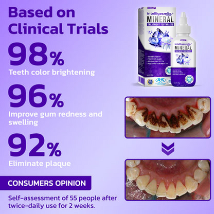 🥇BBOJI™ IntelligeSmile Mineral Treatment Toothpaste