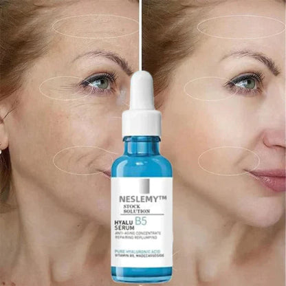 🎁Winter Special-88%-NESLEMY Botox Facial Serum