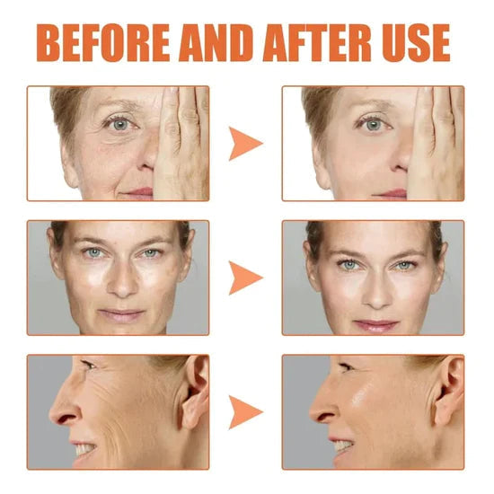 🎁Winter Special-88%-NESLEMY Botox Facial Serum