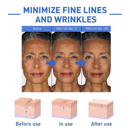🎁Winter Special-88%-NESLEMY Botox Facial Serum