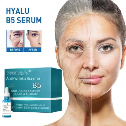 🎁Winter Special-88%-NESLEMY Botox Facial Serum
