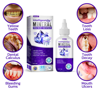 🥇BBOJI™ IntelligeSmile Mineral Treatment Toothpaste