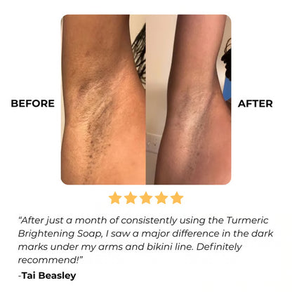 🔥Turmeric & Kojic Acid Brightening Soap