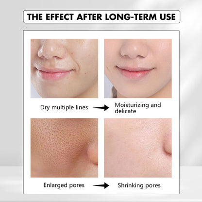 🎁Winter Special-80%-Insideefy Firming Peptide Lifting Serum