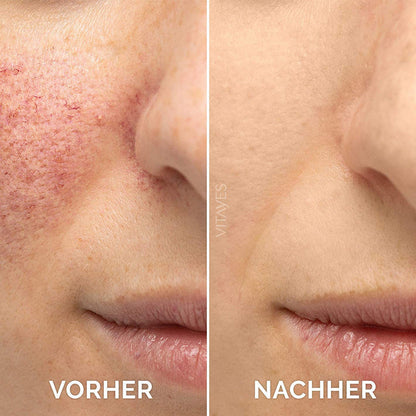 🎁Winter Special-80%-Insideefy Firming Peptide Lifting Serum