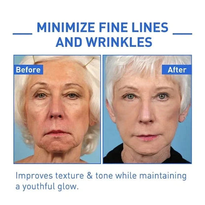 🎁Winter Special-88%-NESLEMY Botox Facial Serum